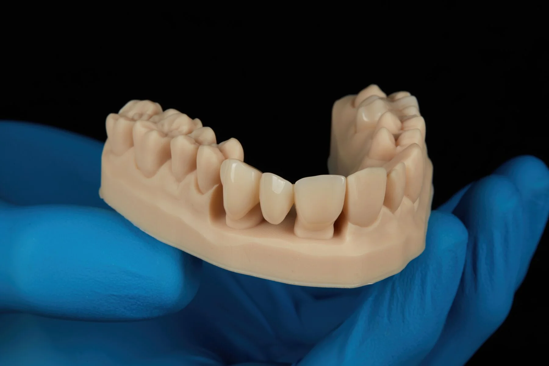 Formlabs Dental - BEGO™ VarseoSmile® TriniQ® Resin - Image 3