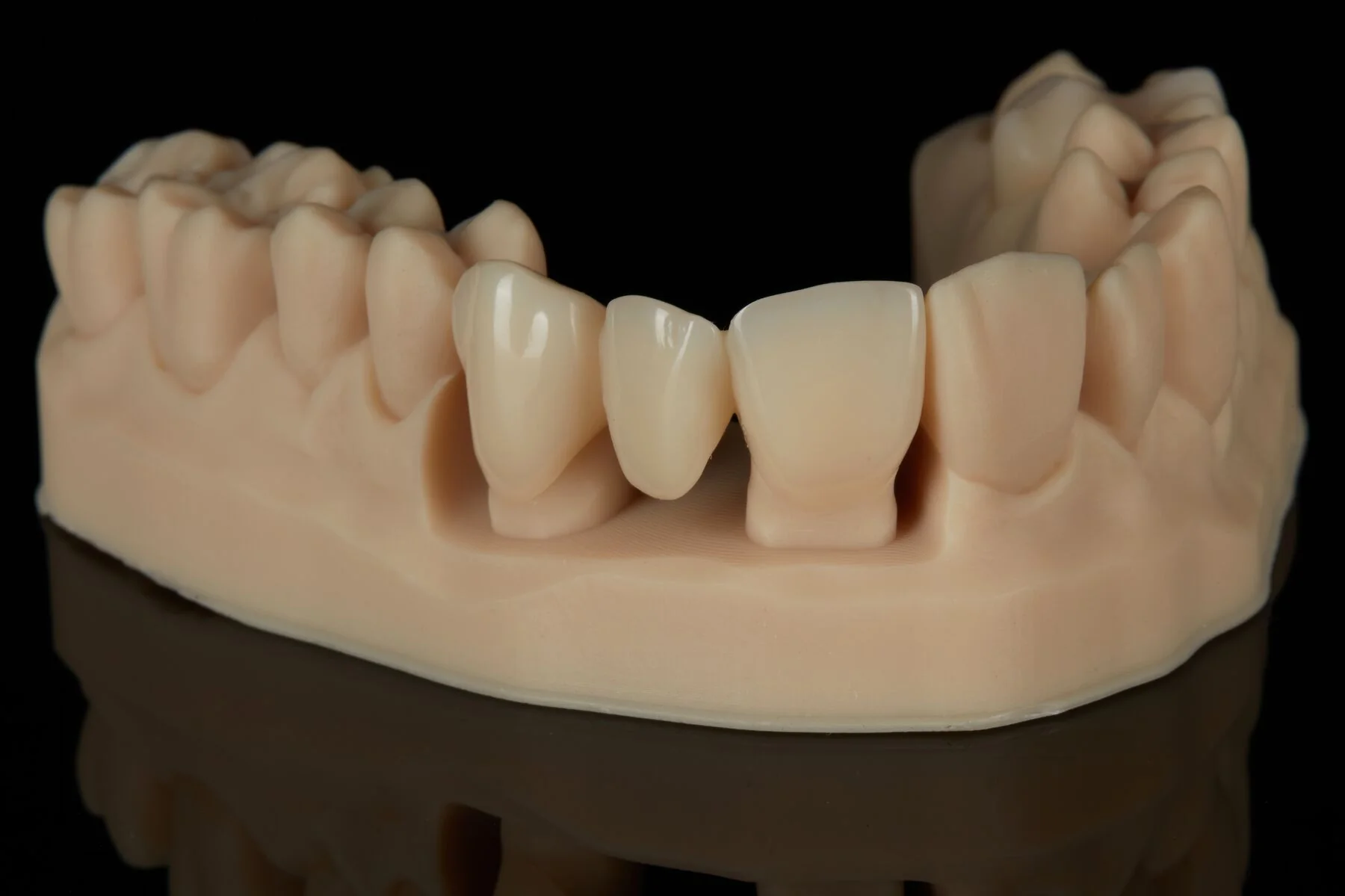 Formlabs Dental - BEGO™ VarseoSmile® TriniQ® Resin - Image 4